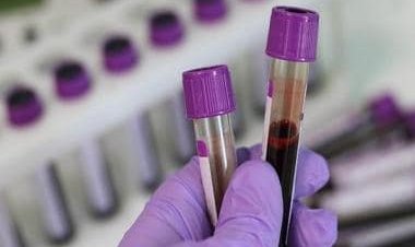 Explained: What is the Ebola-like Marburg virus reported in Ghana?
