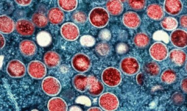 The world is ‘losing the window’ to contain monkeypox, experts warn