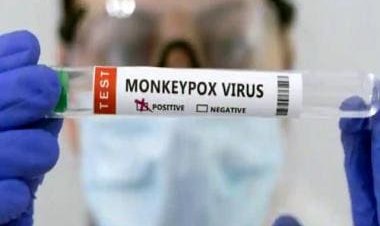 Explained: Why WHO has asked people to reduce sex partners amid monkeypox menace