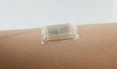 This stick-on ultrasound patch could let you watch your own heart beat