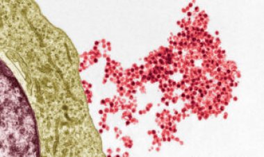 Multiple sclerosis has a common viral culprit, opening doors to new approaches