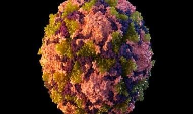 Polio cases reemerge in several Western nations as battle against COVID continues