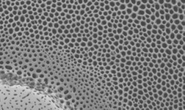 Sea urchin skeletons’ splendid patterns may strengthen their structure