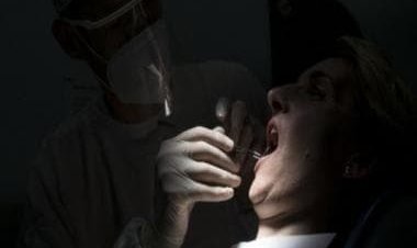 Turkey teeth: A viral trend or a dental disaster?