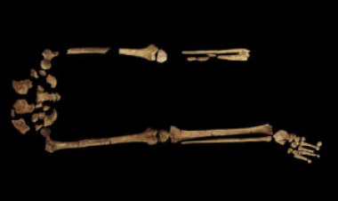 The oldest known surgical amputation occurred 31,000 years ago