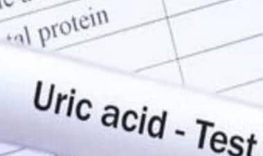 High uric acid levels: Causes and natural remedies for condition
