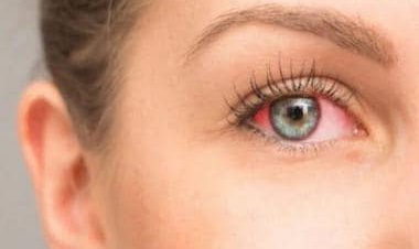 'Silent thief of sight': How glaucoma causes progressive loss of vision