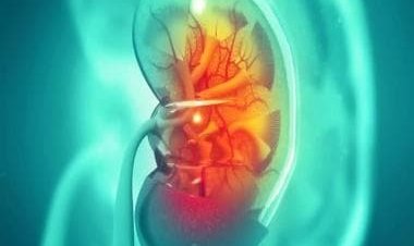How improved technology has revolutionised kidney stone management