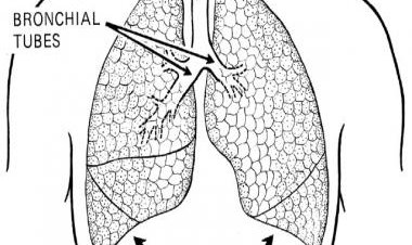 Why rehabilitation post lung transplant is critical to ensure optimum success of procedure