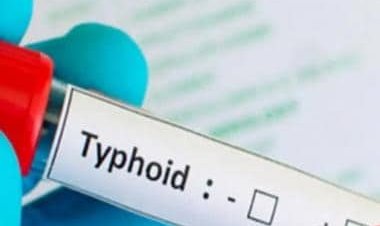 Typhoid treatment: Five home remedies to deal with it