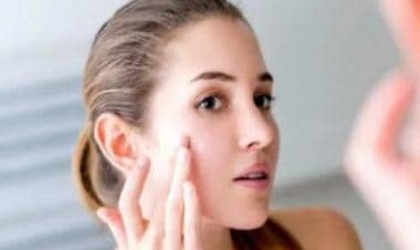 Skin redness: Five ways to reduce it