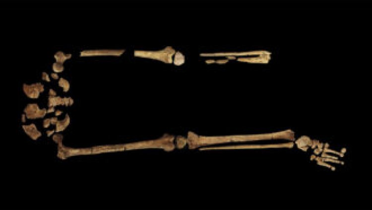 The oldest known surgical amputation occurred 31,000 years ago