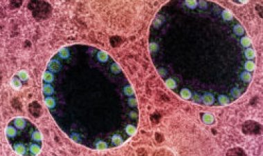 ‘Breathless’ explores COVID-19’s origins and other pandemic science