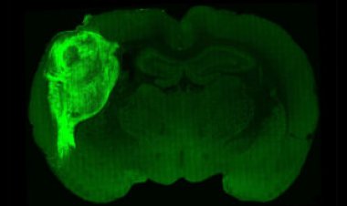 Clumps of human nerve cells thrived in rat brains