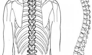 Is your sleeping posture affecting your spine? Know from expert