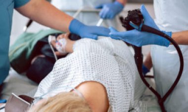 A study questioning colonoscopy screening’s benefits has big caveats