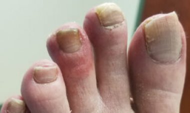 Got a weird COVID-19 symptom? You’re not alone