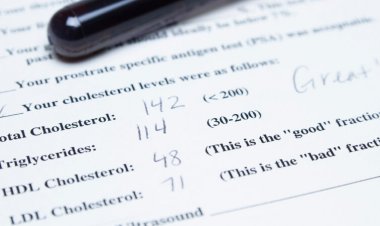 HDL ‘good’ cholesterol isn’t always good for heart health