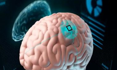Instabrain? Scientists develop brain implant to let people use Insta through minds