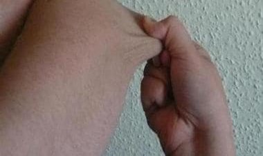 How skin can be a potential indicator for lung diseases