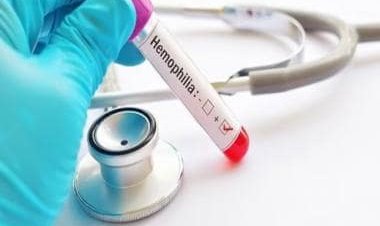 How Hemophilia patients can find relief through correct strategy