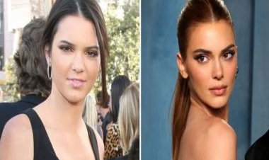 Kendall Jenner hit with fresh 'plastic surgery' rumours; fans believe her looks have 'changed'