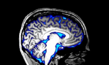 Scientists triggered the flow of spinal fluid in the awake brain