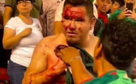 Mexico fan left with blood pouring from chest after being stabbed during Gold Cup match
