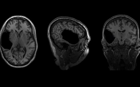 Elyse G.’s brain is fabulous. It’s also missing a big chunk