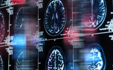 New Alzheimer’s drugs are coming. Here’s what you need to know