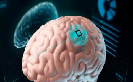 World Brain Day 2023: Strategies to manage stress and protect cognitive function