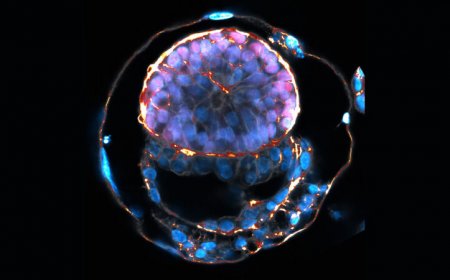 Human embryo replicas have gotten more complex. Here’s what you need to know