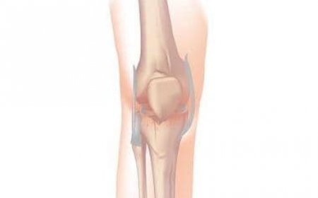 Partial knee replacement: A step towards restored mobility and active living