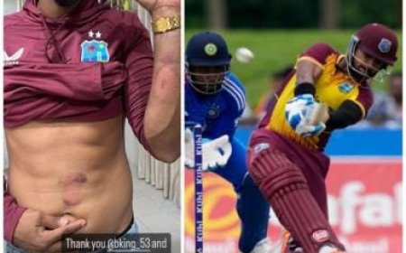 Nicholas Pooran shares photo of his bruised abdomen, forearm, 'thanks' Arshdeep Singh and Brandon King