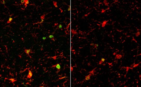 Three ways of rejuvenating aging brains may work via the same protein