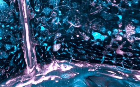 Bone marrow in the skull could be used to monitor Alzheimer’s, MS and more