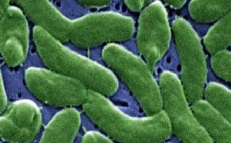 US health agency issues advisory for life-threatening, flesh-eating bacteria