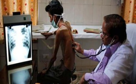 TB trends in Mumbai: Past, present and future