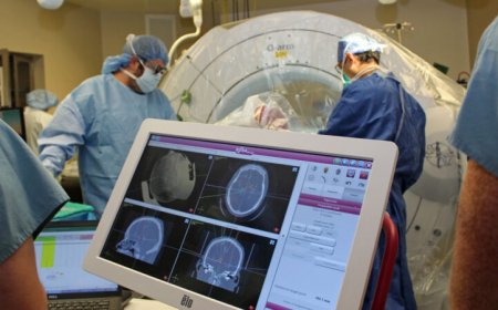 The science behind deep brain stimulation for depression