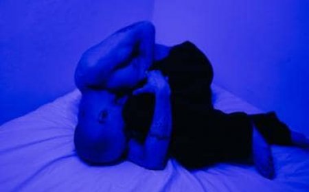 Understanding Depression: Causes, Symptoms, and Treatment