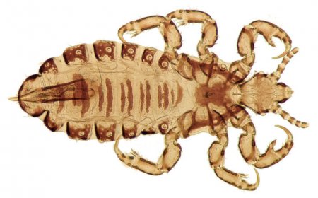 Head lice hitched a ride on humans to the Americas at least twice