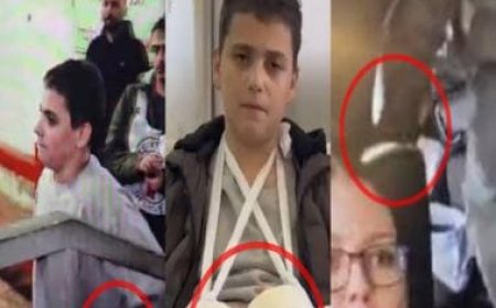WATCH Hamas shenanigans smashed: Teen 'terrorist' freed by Israel wears false cast on hands, caught lying on camera