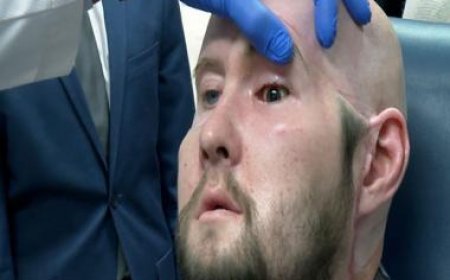 Always hooked to digital screens? You may have dry eyes
