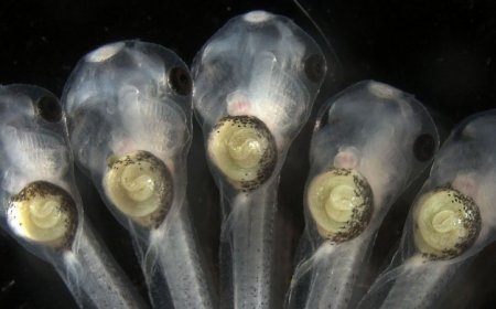 Messed-up metabolism during development may lead guts to coil the wrong way