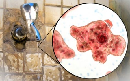 Don’t use unsterilized tap water to rinse your sinuses. It may carry brain-eating amoebas