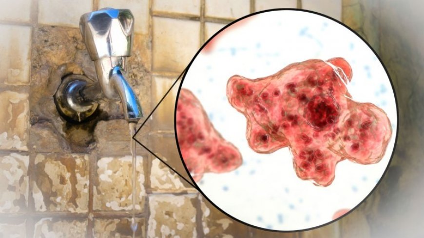 Don’t use unsterilized tap water to rinse your sinuses. It may carry brain-eating amoebas