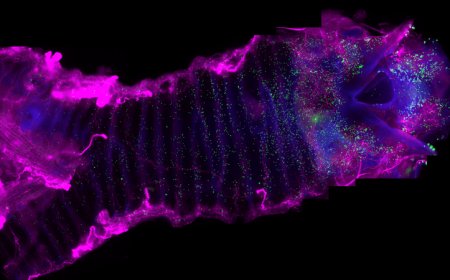 These windpipe cells trigger coughs to keep water out of the lungs