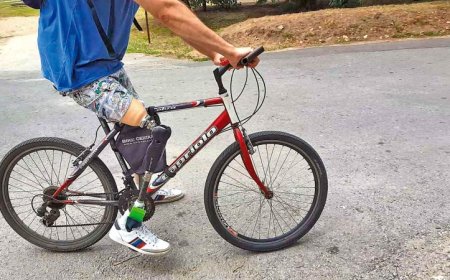 50 years ago, phantom pain was blamed on misfiring nerves 