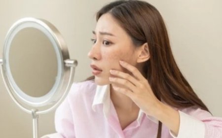 Shahnaz Husain’s Effective Home Remedies to Prevent And Treat Summer Hyperpigmentation