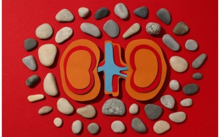 Kidney Stones: These 5 Habits Can Lower Risk of Renal Damage in Summer Season